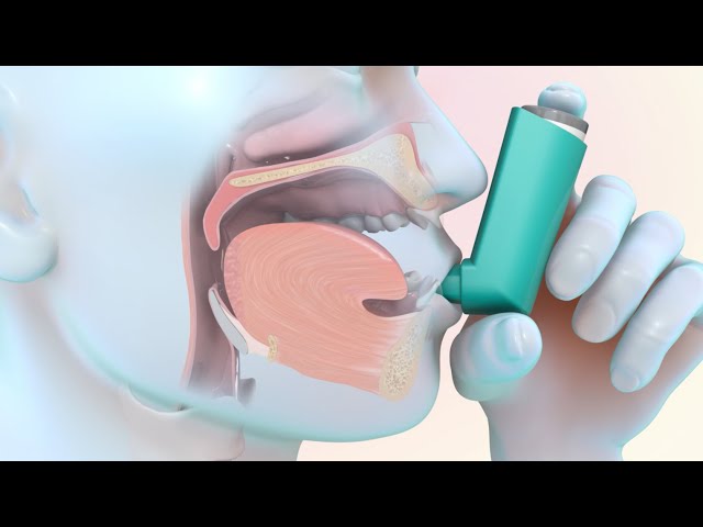 Salbutamol inhalador sin receta