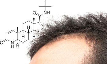 Finasteride capelli costo