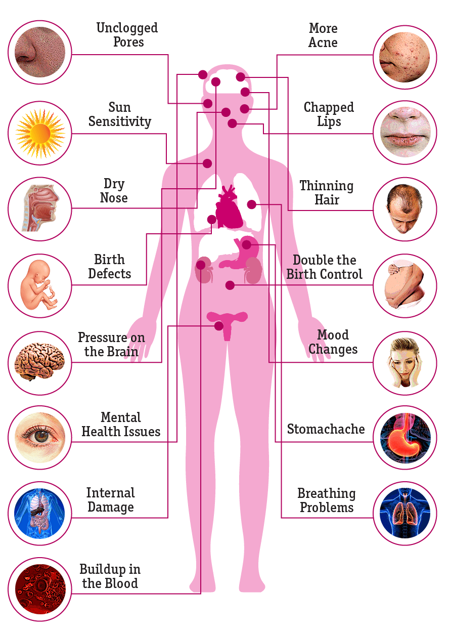 Accutane 30mg