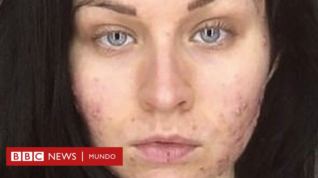 como comprar accutane