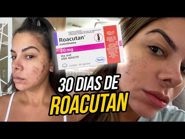 Roacutan 60 capsulas