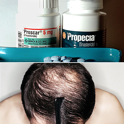 Finasteride En Línea