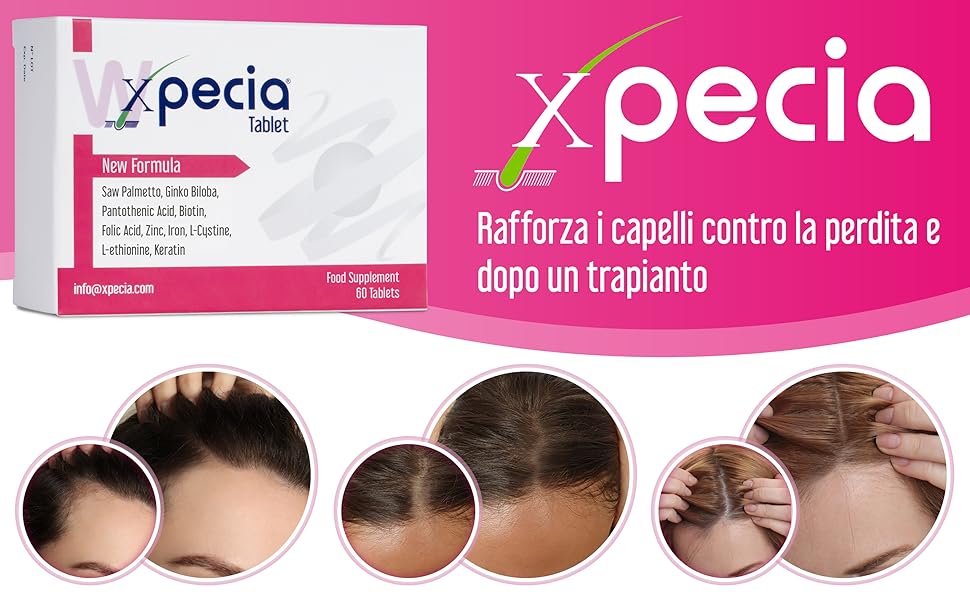 finasteride capelli costo