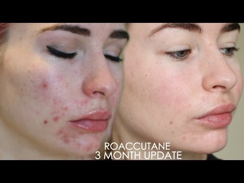 Precio De Roaccutane