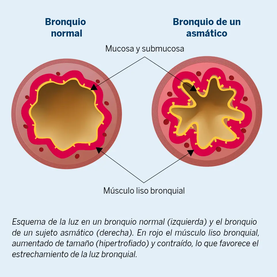 salbutamol inhalador sin receta