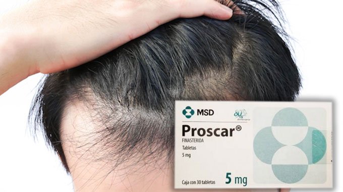 Precio proscar 5 mg