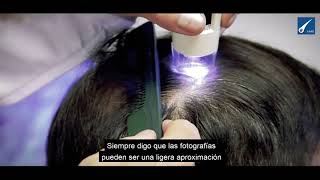 Finasteride mujeres comprar