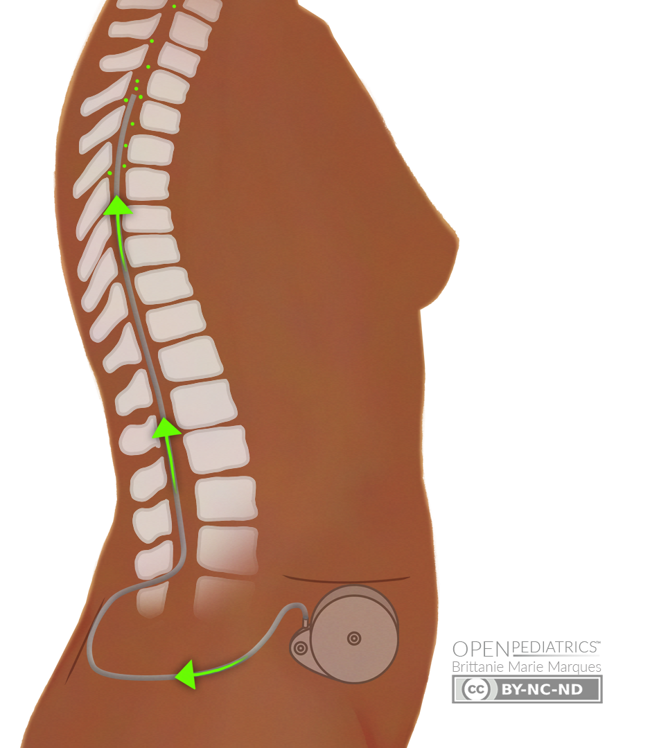 Lioresal baclofeno precio