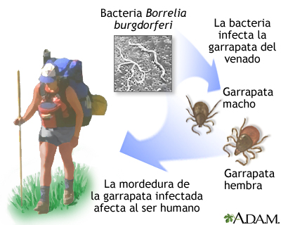 Azithromycin traducción en español