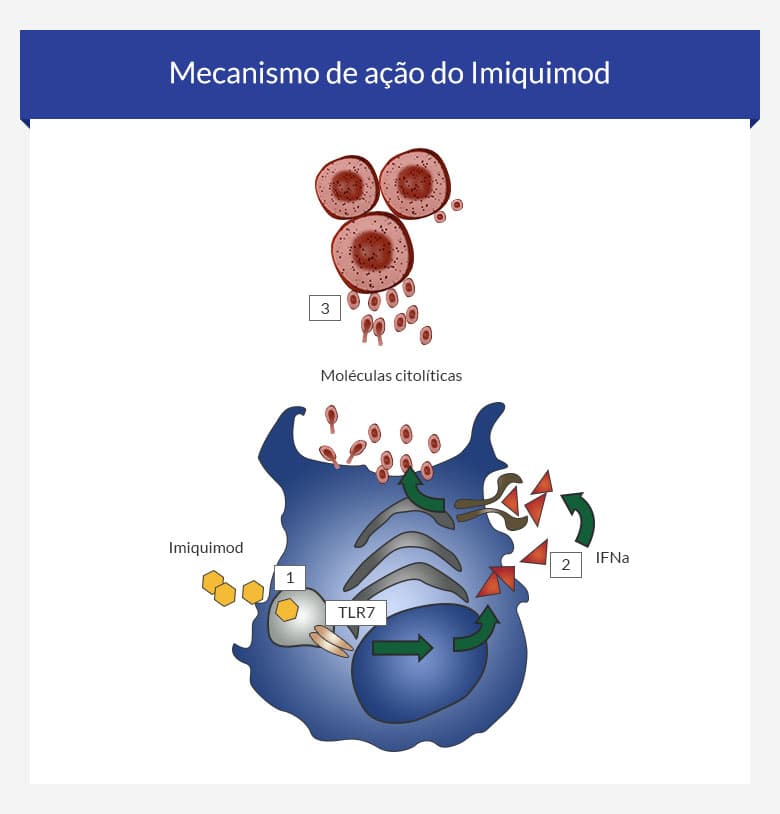 Comprar ixium imiquimod