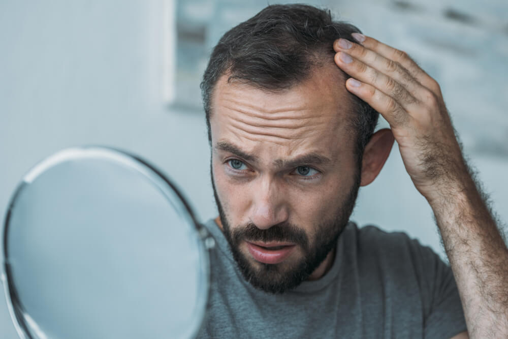 Cómo comprar finasteride