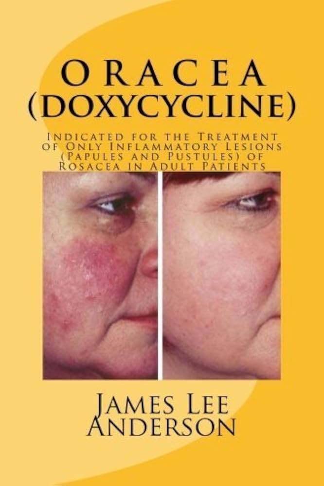 Pedido Doxycycline En Línea