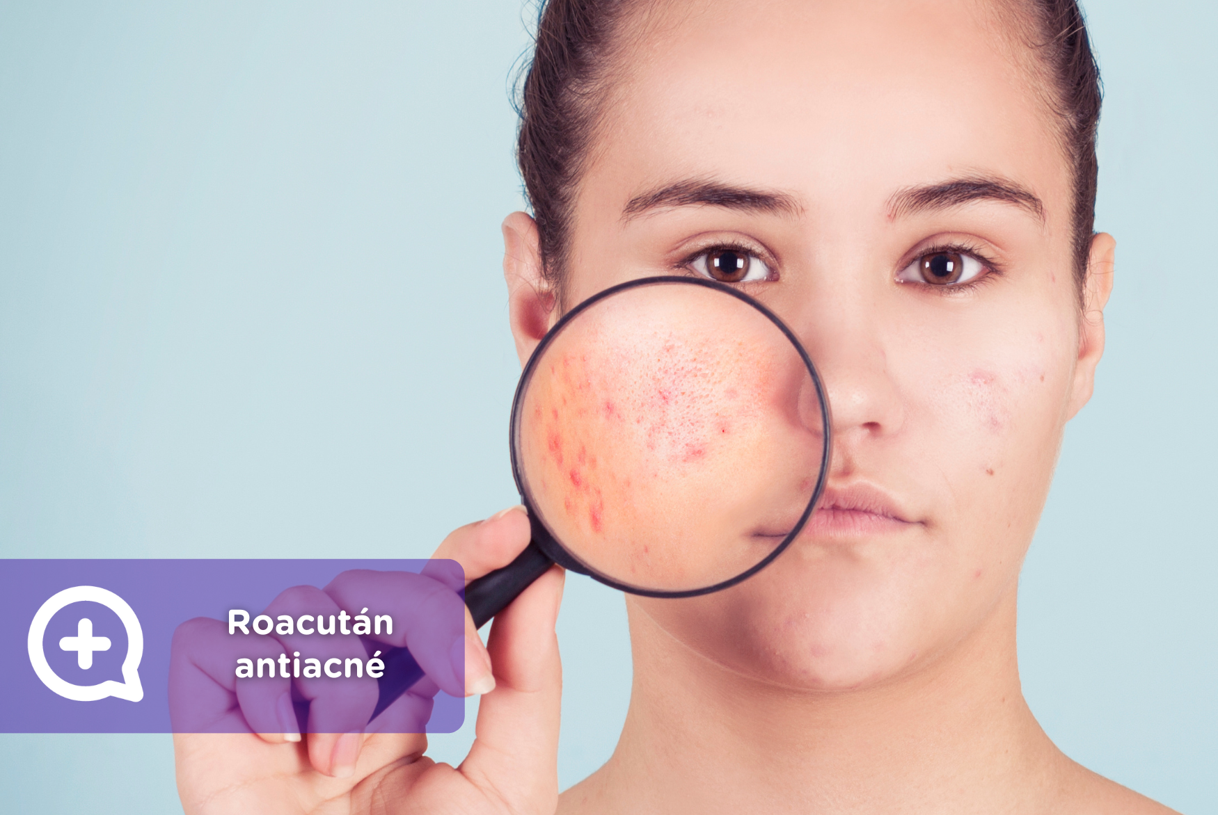 roacutan pastillas acne