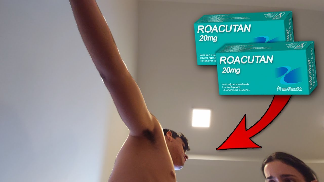 Roacutan precio